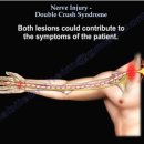 한양한의원 | 구리한의원) 발바닥 감각이 사라진 50대 남성