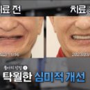 인생플란트 치과기공소 이미지