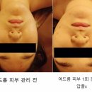 로뎀스킨케어 이미지