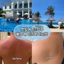 김정문알로에 논공행복점 | 햇빛에 탄 피부 빠르게 진정시키는 법 (알로에젤 + 판테놀연고크림 후기)
