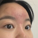 왕십리피부관리_오닉스스킨테라피에서 피부 재생관리 받고 왔어요!