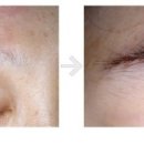 나용필모피부과의원 이미지