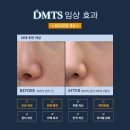 피부,맑음 이미지