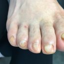 레푸스 앤 쓰담네일 이미지