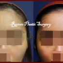 로코코성형외과의원 이미지