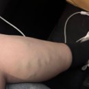 한사랑병원 | [임신30주차] 30. 목포한사랑병원으로 전원하기