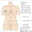 제니센의료기 Daum카페