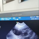 히페리온코리아 이미지