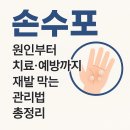 통증 예방 치료 기체조 | 손수포 가려움·통증 심할 때 대처법과 생활 속 예방법