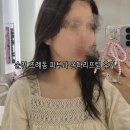 조례동 | 순천 조례동 피부과 온다리프팅 후기