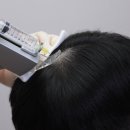 닥터안헤어플란트의원 네이버블로그
