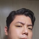 결국 주사 맞고 원형탈모 극복 후기 그외 잡썰