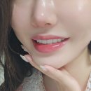 생활웃음 | 레브치과 신사역 치아미백 3주차, 생활 속에서 달라진 웃음 자신감 후기