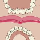 교정몬을 위한 구강 클리닉 제품 추천&후기 이미지