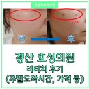 효성의원 | 경산 효성의원 리터치 후기│주말 도착시간, 가격, 주차 등 솔직후기