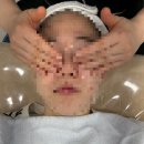 6287 | 울산동구 예신 신부 피부관리 에스떼청담 나비존 모공관리 후기