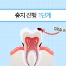 유디상무치과의원 네이버블로그