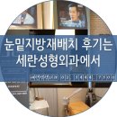 눈밑지방재배치후기는 세란성형외과에서