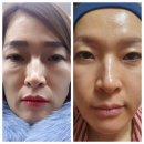 인셀덤신화