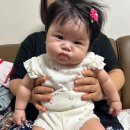 5개월아기 신생아사경 좌측사경 연세로이재활의학과