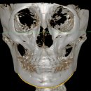 (주)코리아메디케어 | 안면비대칭 교정의 핵심은, 먼저 ‘어디가 비대칭인지’ 아는 것