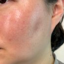 주식회사 광채 | 보습 미백 진정 광채를 한 번에 와이트리 광채릴리세럼 후기