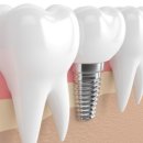 이플랜치과의원 이미지