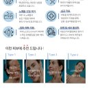 블링데이 이미지