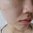 30대직장인 하이푸 홈케어 디바이스 듀얼소닉맥시멈 관리 후기