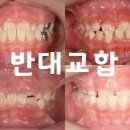 울산BS치과교정과치과의원 네이버블로그
