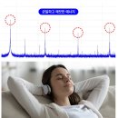 U K POP STAR(복합-13) | 왜 듀얼테트라인가? 과학으로 증명된 파라메터 복합 에너지 뷰티 디바이스 효과 분석 (KMEDI hub 데이터)