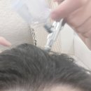 럭키빌딩 | 산본 두피관리 도노포레스타 두피케어 산본점 탈모집중 스페셜 케어 후기