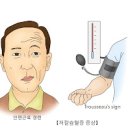 칼륨 부족 및 과다 과 : 저칼륨혈증 고칼륨혈증 이미지