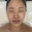서면카센타 | 사직피부관리 라비뉴에스테틱 윤곽관리와 수분충전을 한번에 베이직관리 후기