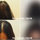 모발을 채우다 이미지