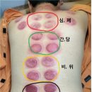 심준보한의원 네이버블로그