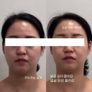 마노아뷰티 - 서구 | 청주비대칭교정 체형분석까지 신기한 호흡테라피 마노아뷰티!