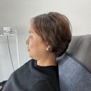 페이스라인치과의원 | 강남 논현역피부과 영영영의원 제로튠리프팅 리얼후기 튠페이스 효과 좋아요