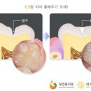 효치과 이미지