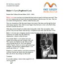 ＜나눔자료-2014-04-25＞ Baker`s Cyst (Popliteal Cyst) : 무릎뒤의 물혹! 베이커씨 낭종에 대해 아시나요? 이미지