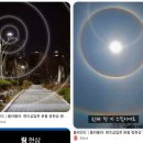 샘쿠 | 렌즈삽입술 고도근시 난시 한 달 경과 장단점 후기 강남 안과 ㅇㅅㅇㅇ 내돈내산