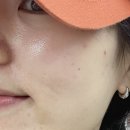 나루바이오 | [송파에스테틱] 송파바이오포톤 관리｜정성 가득 손결애에스테틱 후기🧖‍♀️