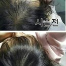 앤스킨케어 - 남구 | 앤스킨케어