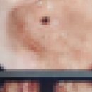 다원약국 | 연세닥터스내과에서 위내시경