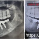 선구강악안면외과치과의원 이미지