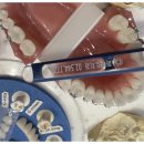 서울퍼펙트치과의원 네이버블로그
