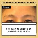노블성형외과의원 이미지