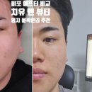 치유앤뷰티 명지 윤곽관리 리프팅 추천