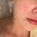[서울/영등포] 문래피부관리 라온스킨앤바디 문래점 스페셜 관리 후기
