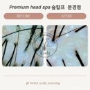문경두피관리 점촌두피관리 숲칼프 두피스케일링 재방문 후기 탈모관리